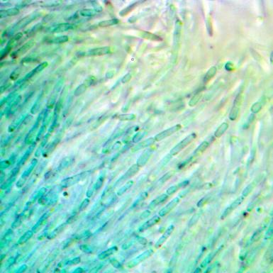 在显微镜下Anthocerotibacter panamensis