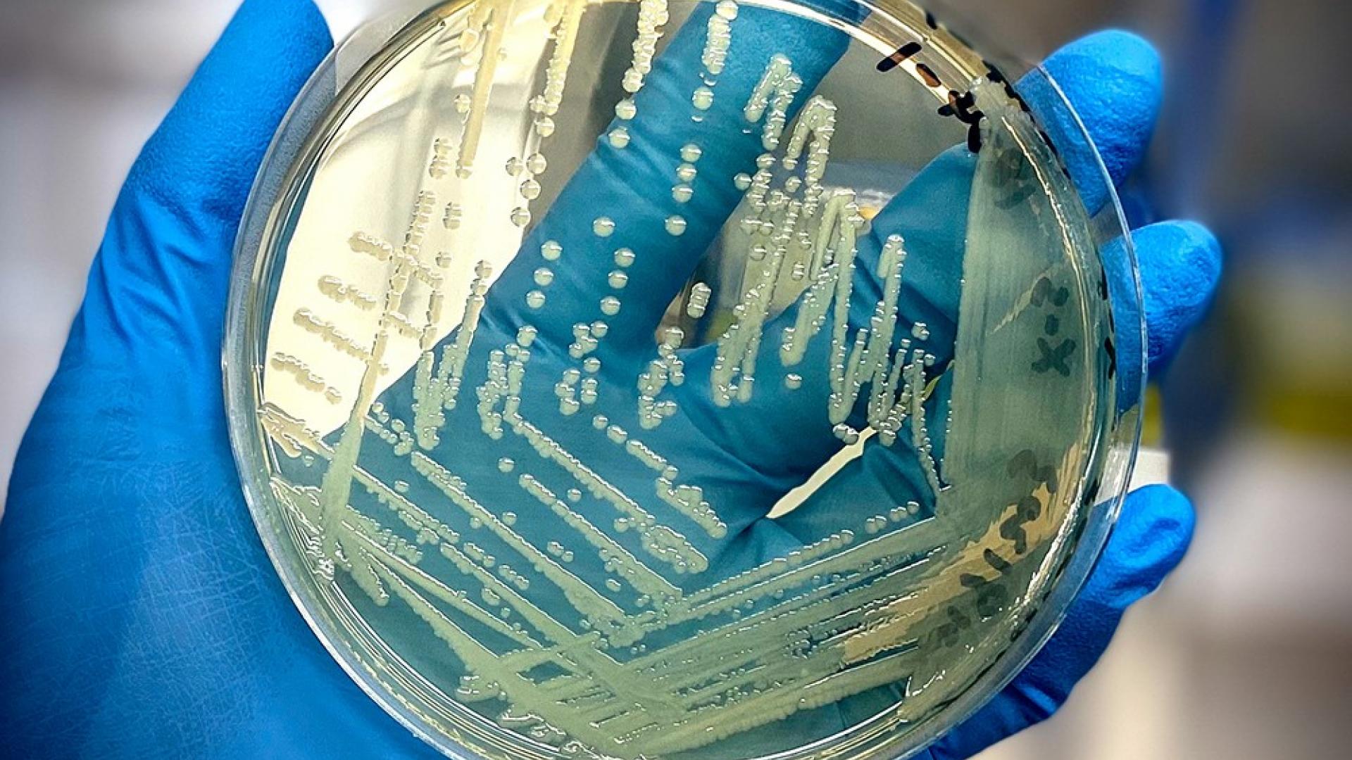 戴着手套的手用沙门氏菌细胞抓住琼脂牌